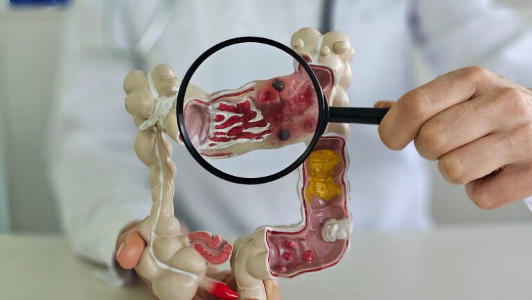 metoda-prin-care-specialistii-vor-sa-descopere-de-ce-tot-mai-multi-tineri-sunt-diagnosticati-cu-cancer.-„o-resursa-unica”