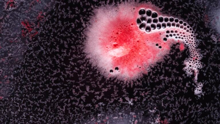 o-bacterie-comuna-in-ochi-ar-putea-provoca-alzheimer