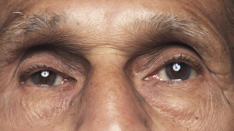 o-bacterie-prezenta-in-ochi,-asociata-cu-boala-alzheimer-si-declinul-cognitiv,-arata-un-nou-studiu