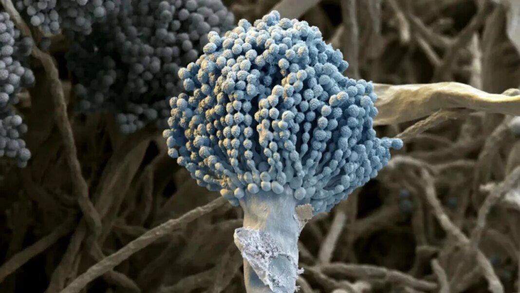 o-ciuperca-mortala-care-„mananca”-corpul-din-interior-se-extinde-rapid-la-nivel-global