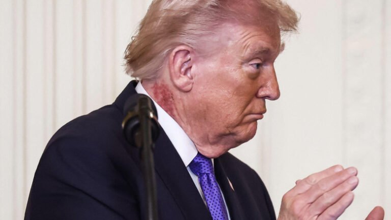 noi-intrebari-despre-starea-de-sanatate-a-lui-donald-trump.-ce-este-pata-rosie-aparuta-pe-gatul-presedintelui-american