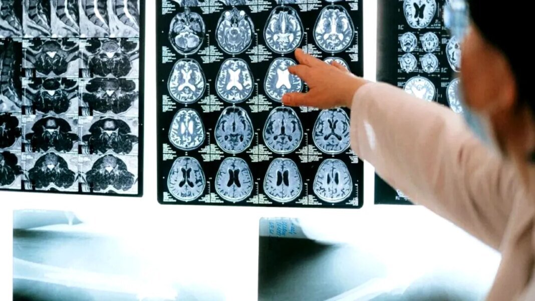 descoperire-in-neurostiinta:-un-cercetator-german-explica-modul-in-care-functioneaza-sistemul-de-navigatie-al-creierului-uman