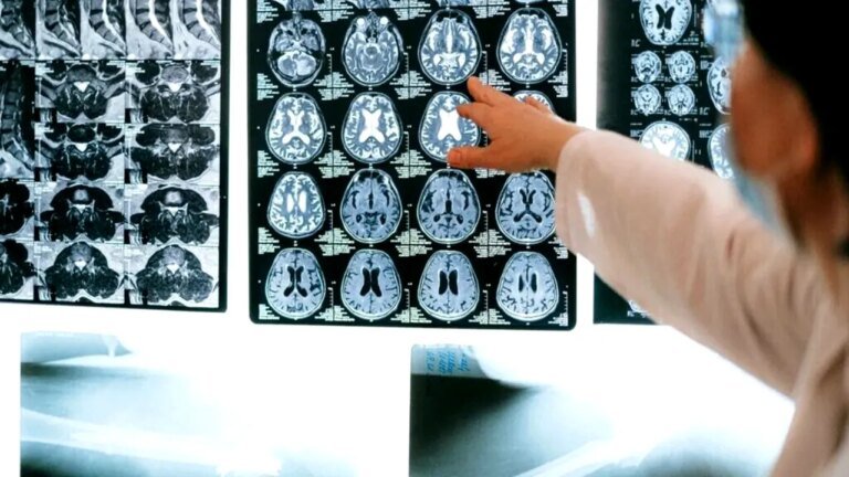 descoperire-in-neurostiinta:-un-cercetator-german-explica-modul-in-care-functioneaza-sistemul-de-navigatie-al-creierului-uman