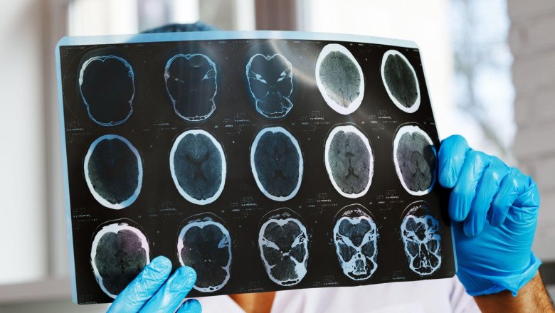 asociatiile-de-pacienti-cer-interventia-ministerului-sanatatii-si-cnas-dupa-scaderea-cu-47%-a-investigatiilor-de-monitorizare asociatiile-de-pacienti-cer-interventia-ministerului-sanatatii-si-cnas-dupa-scaderea-cu-47%-a-investigatiilor-de-monitorizare