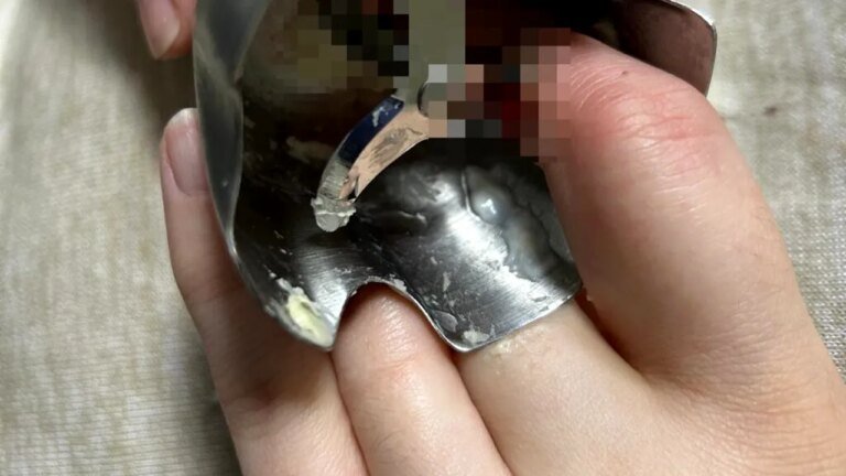 doua-femei-din-iasi-au-ajuns-la-spital-in-urma-unor-accidente-casnice-grave