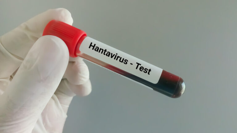 suspiciune-de-infectie-cu-hantavirus-in-cazul-unui-pompier-de-la-isu-caras-severin.-barbatul-ar-fi-calatorit-in-serbia