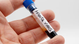 tanarul-din-arad-confirmat-cu-hantavirus-a-fost-externat