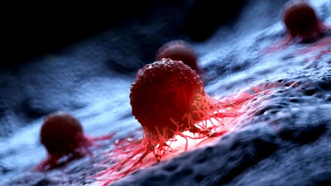 un-nou-tip-de-terapie-ar-putea-ajuta-la-tratarea-cancerului.-rezultate-pozitive-dupa-un-prim-studiu