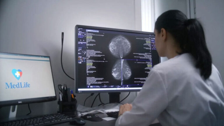 avc-ischemic-la-doar-35-ani.-malformatia-care-i-a-pus-viata-in-pericol,-tratata-printr-o-procedura-minim-invaziva