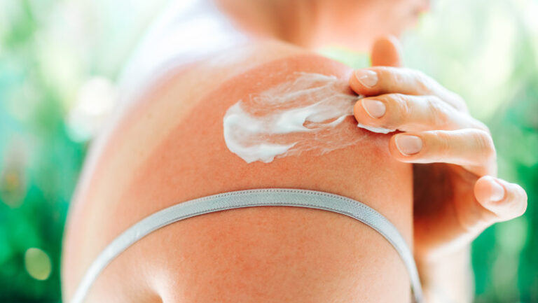 ce-face-o-crema-cu-spf-sa-fie-cu-adevarat-eficienta.-dermatologii-explica-cum-poate-contribui-la-reducerea-riscului-de-cancer-de-piele