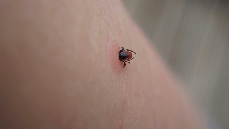 ue-evalueaza-un-vaccin-pfizer-impotriva-bolii-lyme,-infectie-transmisa-prin-muscatura-de-capusa ue-evalueaza-un-vaccin-pfizer-impotriva-bolii-lyme,-infectie-transmisa-prin-muscatura-de-capusa